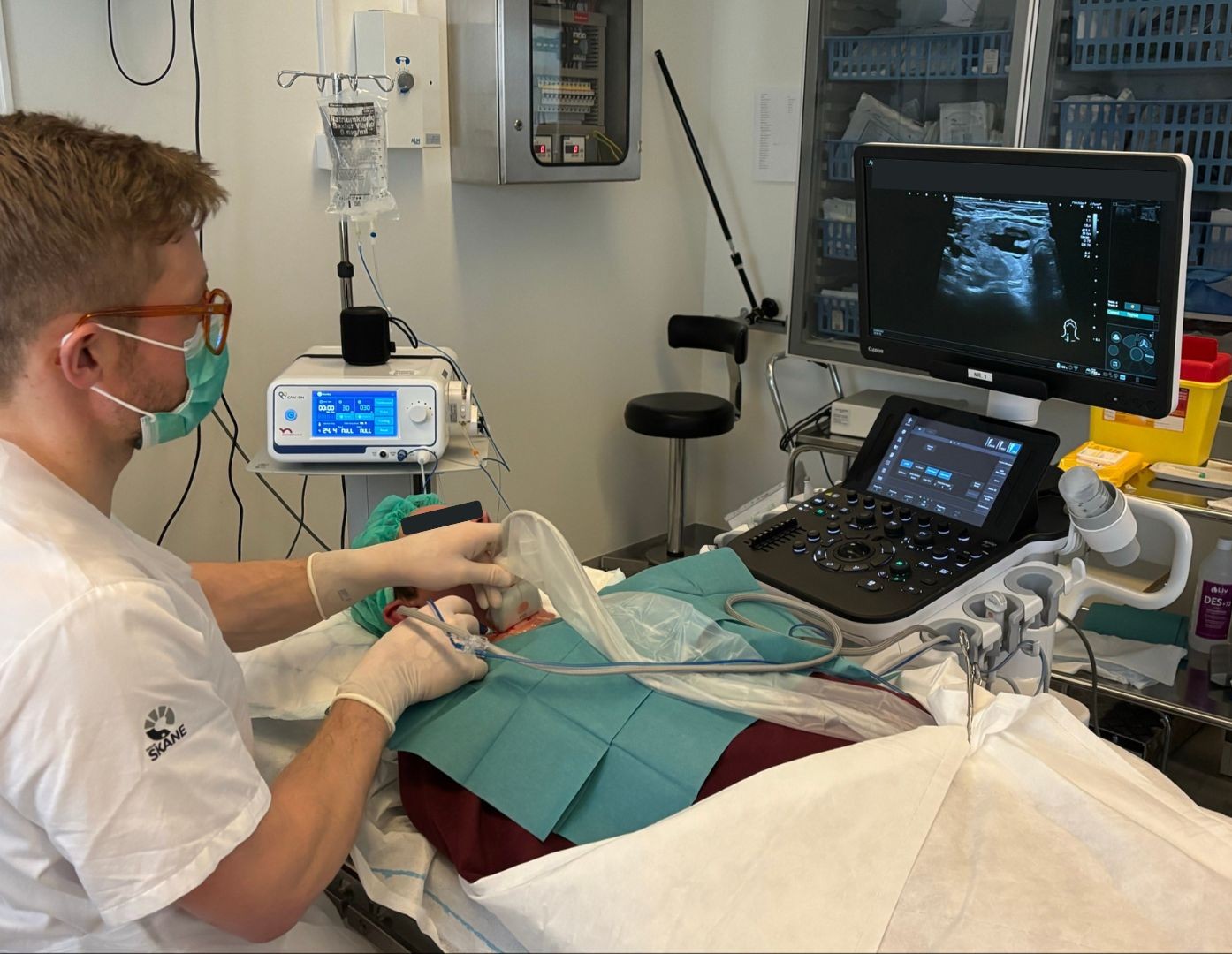 First Microwave Ablation of Benign Thyroid Nodules in Sweden