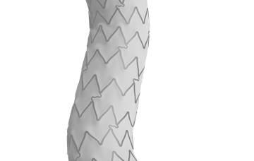 iCover Covered Stent